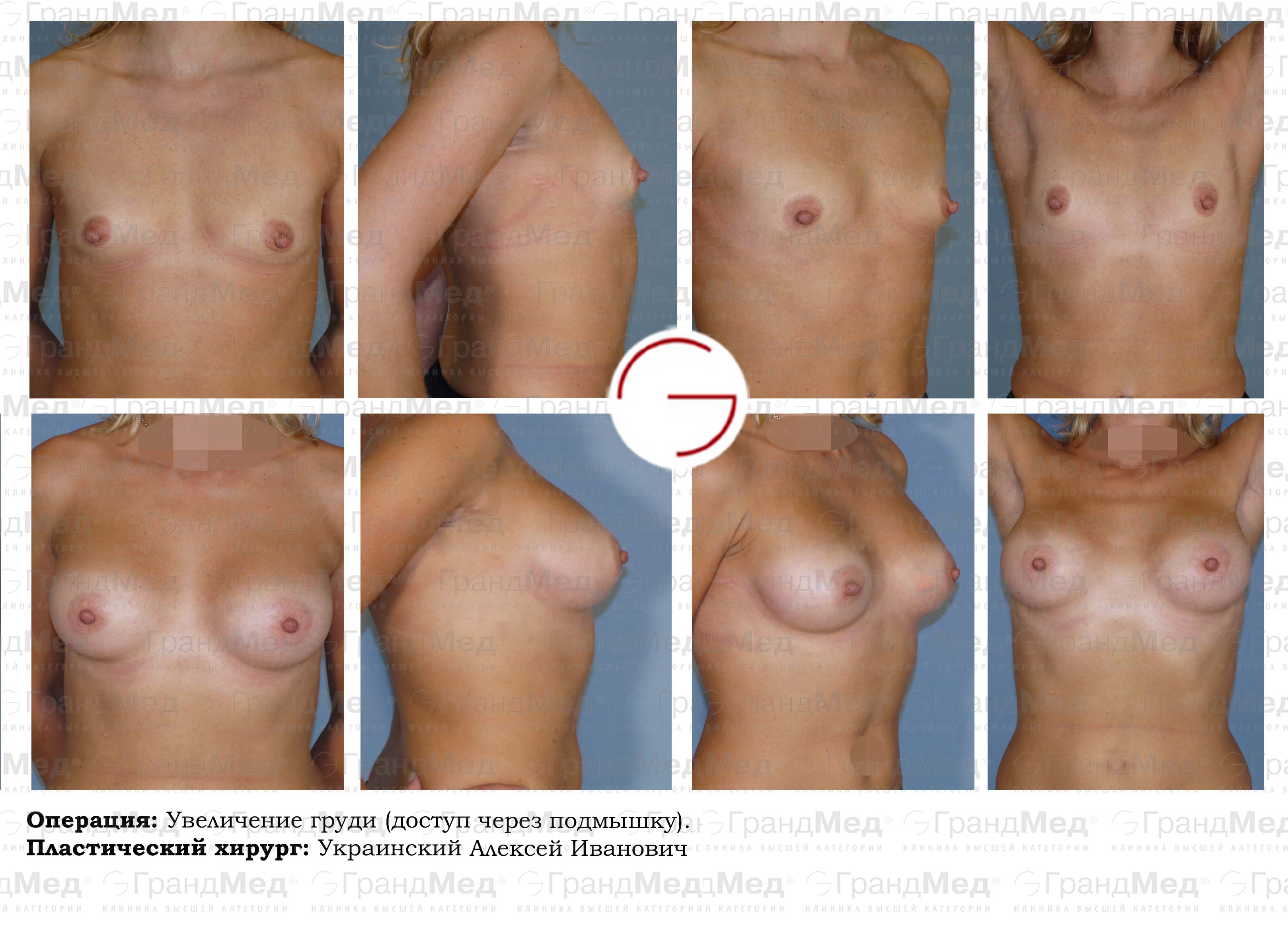 грудь во время беременности до и после фото фото 18